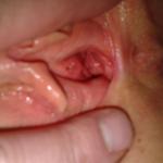 ������� -�����