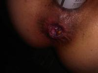 ��� �������