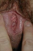 ������� �� ����