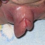 ������ ����� ��������